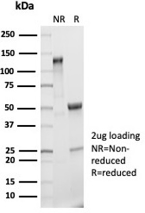 SDS-PAGE Analysis Purified IL-2 Recombinant Rabbit Monoclonal Antibody (IL2/7050R). Confirmation of Purity and Integrity of Antibody.
