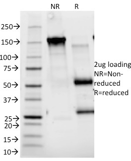 SDS-PAGE Analysis of Purified CD25 Mouse Monoclonal Antibody (143-13). Confirmation of Integrity and Purity of Antibody.
