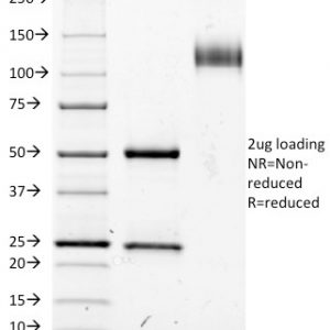 SDS-PAGE Analysis of Purified CD25 Mouse Monoclonal Antibody (IL2RA/423).