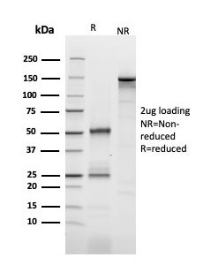 SDS-PAGE Analysis of Purified CD25 Mouse Monoclonal Antibody (IL2RA/2393). Confirmation of Purity and Integrity of Antibody.
