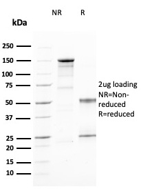 SDS-PAGE Analysis Purified CD25 Mouse Monoclonal Antibody (IL2RA/2394). Confirmation of Purity and Integrity of Antibody.