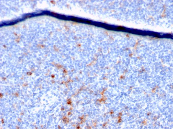 Formalin-fixed, paraffin-embedded human Tonsil stained with CD25 Mouse Monoclonal Antibody (IL2RA/2395).