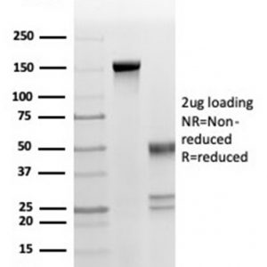 SDS-PAGE Analysis Purified Fas Ligand (FASLG) Mouse Monoclonal Antibody (FASLG/4453). Confirmation of Purity and Integrity of Antibody.