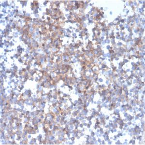 Formalin-fixed, paraffin-embedded human tonsilstained with Fas Ligand (FASLG)Mouse Monoclonal Antibody (FASLG/4455).