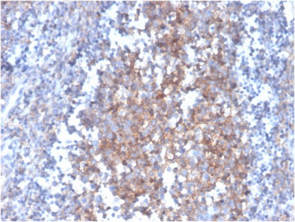 Formalin-fixed, paraffin-embedded human tonsil stained with Fas Ligand (FASLG) Mouse Monoclonal Antibody (FASLG/4455).