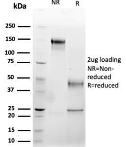 SDS-PAGE Analysis of Purified Fas Ligand (FASLG) Mouse Monoclonal Antibody (FASLG/4456). Confirmation of Purity and Integrity of Antibody.