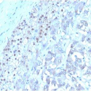 Formalin-fixed, paraffin-embedded human adrenalgland stained with Interleukin-3 (IL-3) Mouse Monoclonal Antibody(I L3/4001). HIER: Tris/EDTA, pH9.0, 45min. 2°C: HRP-polymer, 30min. DAB, 5min.