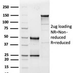 SDS-PAGE Analysis of Purified Interleukin-3 (IL-3) Mouse Monoclonal Antibody (IL3/4005). Confirmation of Purity and Integrity of Antibody.