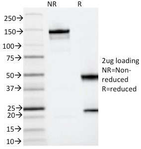 SDS-PAGE Analysis of Purified CD123 Mouse Monoclonal Antibody (IL3RA/2065). Confirmation of Integrity and Purity Antibody.