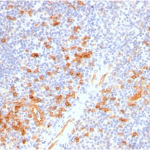 Formalin-fixed, paraffin-embedded human Tonsil stained with IL3RA / CD123 Rabbit Recombinant Monoclonal Antibody (IL3RA/2947R).