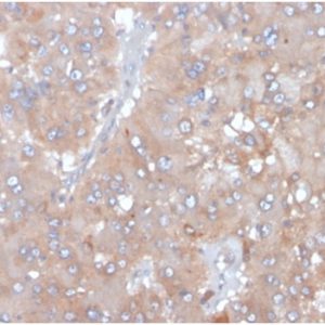 Formalin-fixed, paraffin-embedded human adrenalgland stained with Interleukin-5 (IL-5) Mouse Monoclonal Antibody (IL5/4161). HIER: Tris/EDTA, pH9.0, 45min. 2°C: HRP-polymer, 30min. DAB, 5min.