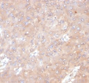 Formalin-fixed, paraffin-embedded human tonsil stained with IL-6 Mouse Monoclonal Antibody (IL6/4641) at 2ug/ml. HIER: Tris/EDTA, pH9.0, 45min. 2°C: HRP-polymer, 30min. DAB, 5min.