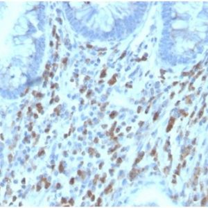 Formalin-fixed, paraffin-embedded human adrenalgland stained with IL6RB / CD130 Mouse Monoclonal Antibody (IL6ST/4101). HIER: Tris/EDTA, pH9.0, 45min. 2°C: HRP-polymer, 30min. DAB, 5min.