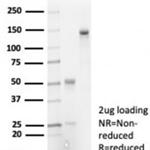 SDS-PAGE Analysis of Purified IL-7 Recombinant Rabbit Monoclonal Antibody (IL7/7053R). Confirmation of Purity and Integrity of Antibody.