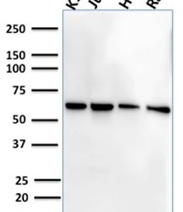 Western Blot Analysis of Human K562, Jurkat, HeLa and Ramos cell lysate using CD127 Mouse Monoclonal Antibody (IL7R/2751).