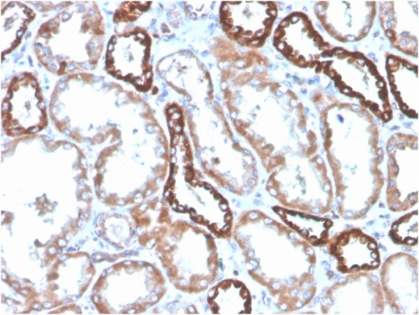 Formalin-fixed, paraffin-embedded kidney stained with CD137 Recombinant Rabbit Monoclonal Antibody (4-1BB/4552R).