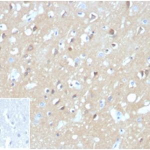 Formalin-fixed, paraffin-embedded human brain stained with Aquaporin (AQP4) Mouse Monoclonal Antibody (AQP4/3324). Inset: PBS instead of primary antibody; secondary only negative control.