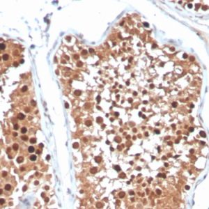 Formalin-fixed, paraffin-embedded human testicular carcinoma stained with Inhibin, alpha Mouse Monoclonal Antibody (R1).