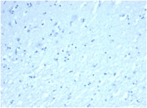 IHC analysis of formalin-fixed, paraffin-embedded human brain. Negative tissue control using rINHA/6919at 2ug/ml in PBS for 30min RT. HIER: Tris/EDTA, pH9.0, 45min. 2 °: HRP-polymer, 30min. DAB, 5min.