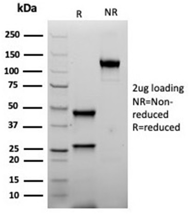 SDS-PAGE Analysis Purified Inhibin, alpha Recombinant Mouse Monoclonal (rINHA/6919). Confirmation of Purity and Integrity of Antibody.