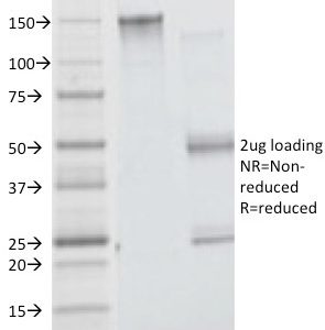 SDS-PAGE Analysis of Purified Insulin Receptor Mouse Monoclonal Antibody (INSR/1661). Confirmation of Integrity and Purity of Antibody.