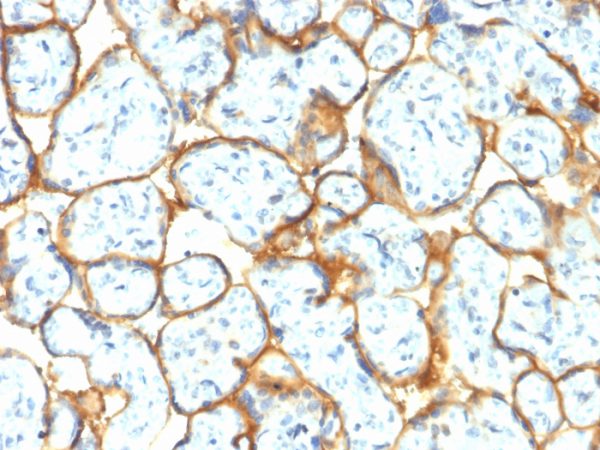 Formalin-fixed, paraffin-embedded human Placenta stained with Insulin Receptor Rabbit Recombinant Monoclonal Antibody (INSR/2277R).