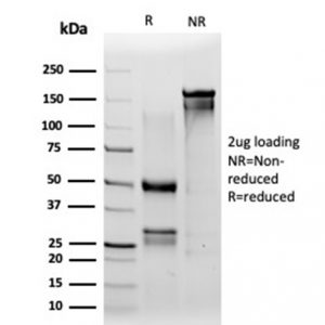 SDS-PAGE Analysis of Purified IRF3 Mouse Monoclonal Antibody (PCRP-IRF3-1D11). Confirmation of Purity and Integrity of Antibody.