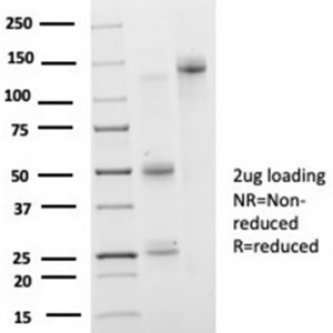 SDS-PAGE Analysis of Purified IRF3 Mouse Monoclonal Antibody (PCRP-IRF3-3B2). Confirmation of Purity and Integrity of Antibody.
