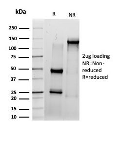 SDS-PAGE Analysis of Purified IRF3 Mouse Monoclonal Antibody (PCRP-IRF3-6H10). Confirmation of Purity and Integrity of Antibody.