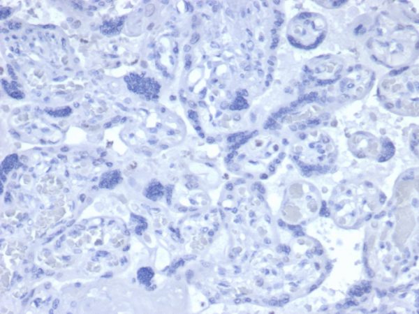 Formalin-fixed, paraffin-embedded human placenta stained with Androgen Receptor Recombinant Rabbit Antibody (DHTR/4445R). Negative tissue control. PBS used instead of 1 ° Ab. HIER and all other steps of protocol identical.