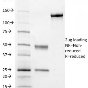 SDS-PAGE Analysis of Purified CD41a Mouse Monoclonal Antibody (ITGA2B/1036). Confirmation of Integrity and Purity of Antibody.