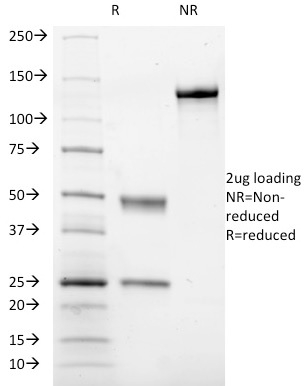 SDS-PAGE Analysis of Purified CD41a Mouse Monoclonal Antibody (ITGA2B/1036). Confirmation of Integrity and Purity of Antibody.