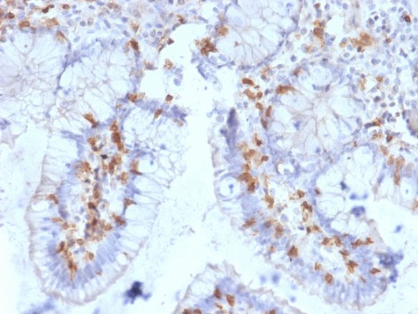 Formalin-fixed, paraffin-embedded human Small Intestine stained with CD103 Mouse Monoclonal Antibody (ITGAE/2063).