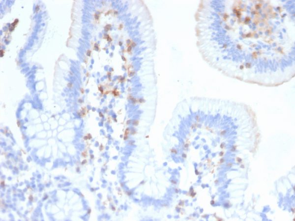 Formalin-fixed, paraffin-embedded human Small Intestine stained with CD103 Mouse Monoclonal Antibody (ITGAE/2474).