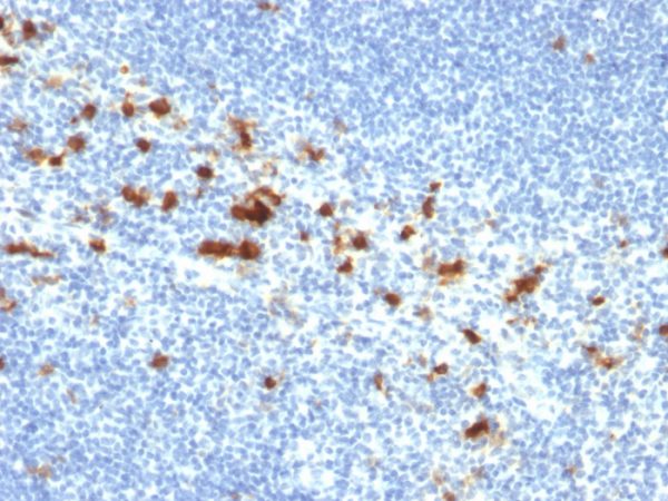 Formalin-fixed, paraffin-embedded human Colon stained with CD103 Mouse Monoclonal Antibody (ITGAE/2474).