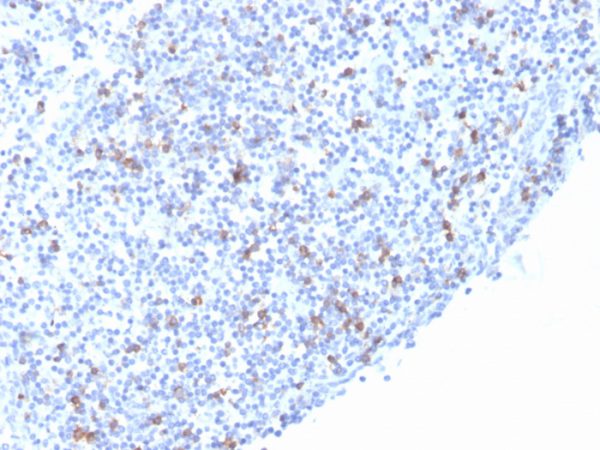 Formalin-fixed, paraffin-embedded human Tonsil stained with CD103 Recombinant Mouse Monoclonal Antibody (rITGAE/2063).