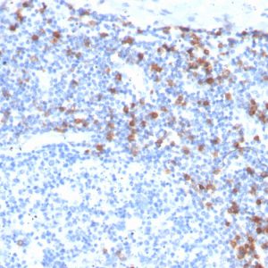 Formalin-fixed, paraffin-embedded human Tonsil stained with CD103 Recombinant Rabbit Monoclonal Antibody (ITGAE/3904R).