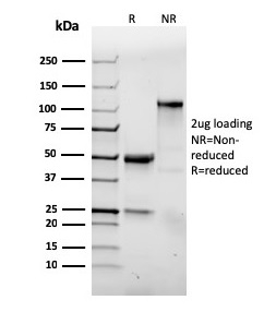 SDS-PAGE Analysis Purified CD103 Recombinant Rabbit Monoclonal Antibody (ITGAE/3904R). Confirmation of Purity and Integrity of Antibody.