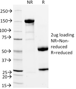 SDS-PAGE Analysis Purified CD11a Mouse Monoclonal Antibody (DF1524). Confirmation of Integrity and Purity of Antibody.