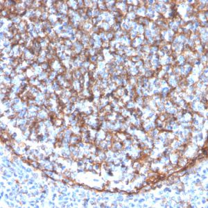 Formalin-fixed, paraffin-embedded human tonsil stained with CD11b Monospecific Mouse Monoclonal Antibody (ITGAM/3340).