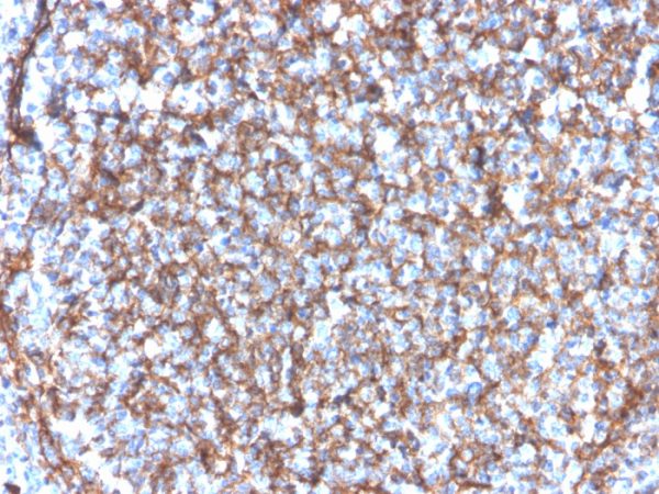 Formalin-fixed, paraffin-embedded human tonsil stained with CD11b Monospecific Mouse Monoclonal Antibody (ITGAM/3340).