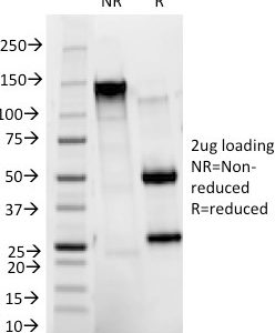 SDS-PAGE Analysis Purified CD11b Mouse Monoclonal Antibody (ITGAM/271). Confirmation of Integrity and Purity of Antibody.