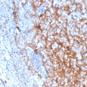 Formalin-fixed, paraffin-embedded human tonsil stained with CD11b Monospecific Mouse Monoclonal Antibody (ITGAM/3337).