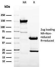 SDS-PAGE Analysis of Purified CD11b Mouse Monoclonal Antibody (ITGAM/3337). Confirmation of Purity and Integrity of Antibody. CD11b / MAC-1 (Microglial Marker) Antibody - Image 3