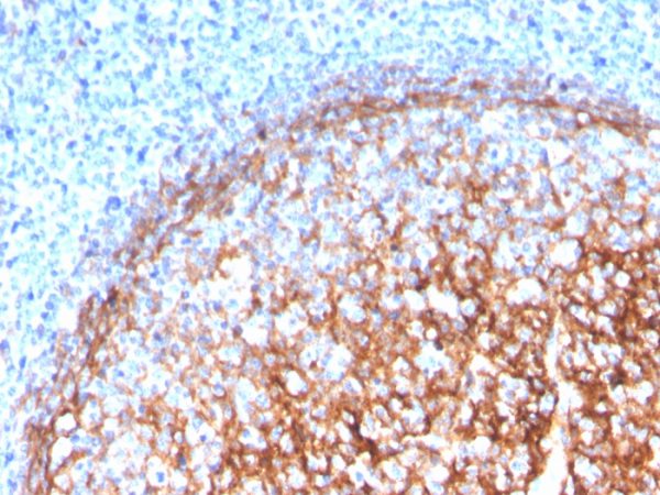 Formalin-fixed, paraffin-embedded human tonsil stained with CD11b Monospecific Mouse Monoclonal Antibody (ITGAM/3339).