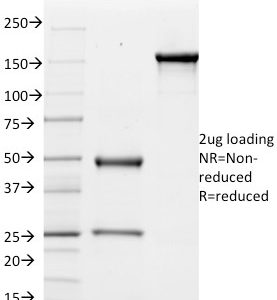 SDS-PAGE Analysis of Purified CD51 / Integrin 'V Mouse Monoclonal Antibody (ITGAV/1610). Confirmation of Purity and Integrity of Antibody.