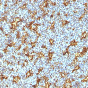 Formalin-fixed, paraffin-embedded human Tonsil stained with CD11c Mouse Monoclonal Antibody (ITGAX/1242).