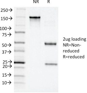 SDS-PAGE Analysis of Purified CD11c Mouse Monoclonal Antibody (ITGAX/1243). Confirmation of Integrity and Purity of Antibody