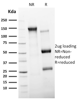 SDS-PAGE Analysis of Purified CD11c Mouse Monoclonal Antibody (ITGAX/2507). Confirmation of Integrity and Purity of Antibody. CD11c (Dendritic Cell Marker) Antibody