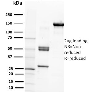 SDS-PAGE Analysis Purified CD29 Mouse Monoclonal Antibody (12G10). Confirmation of Purity and Integrity of Antibody.